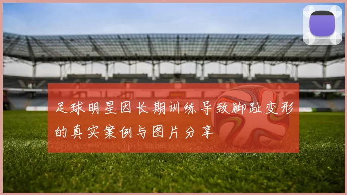 足球明星因长期训练导致脚趾变形的真实案例与图片分享